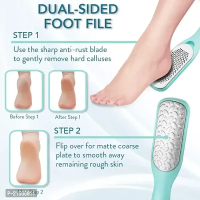 Trendy Look Professional Foot Scrapper/Foot File/Foot Scrubber (FS-18)-thumb5