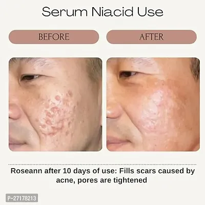 Natural Vitamin C Face Serum-thumb4