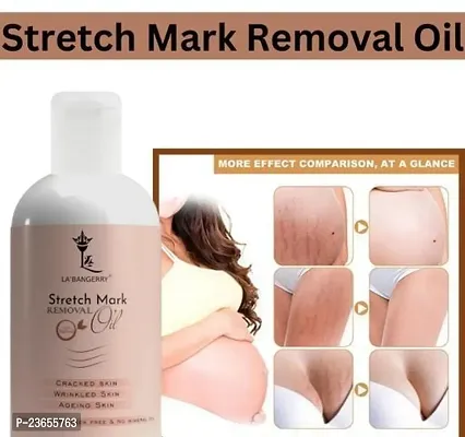 Stretch Mark For Pregnant Women, Pregnant Lady Stretch Mark Oil, Stretch Mark Removal Oil, Stretch Mark Remover Oil, Stretch Mark Cream Pet Ke Stretch Mitaye , Dagh Hata Ne Vala Tel ,Purane Aor Jidii Stretch Hatane Vala Tel-100Ml |Pack Of 1-thumb0