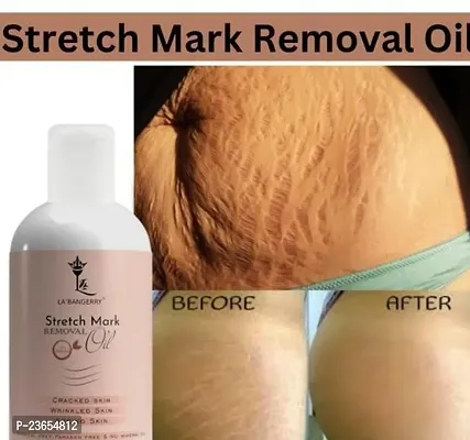 Present Premium Quality Stretch Mark Oil | Remove Stretch Mark | Body Ka Stretch Dur Karne Vala Oil | Best Oil For Stretch Mark | Ageing Skin | (100Ml) Pack Of 1-thumb0