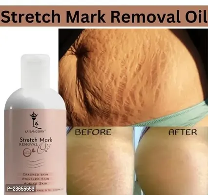 Present Premium Quality Stretch Mark Oil | Remove Stretch Mark | Body Ka Stretch Dur Karne Vala Oil | Best Oil For Stretch Mark | Ageing Skin | (100Ml) Pack Of 1-thumb0