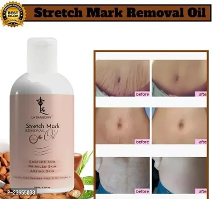 Present High Quality Stretch Mark Oil For Stretch Mark Remover Oil | Pet Ke Stretch Mitaye | Dag Hata Ne Vala Oil |(100Ml) Pack Of 1-thumb0