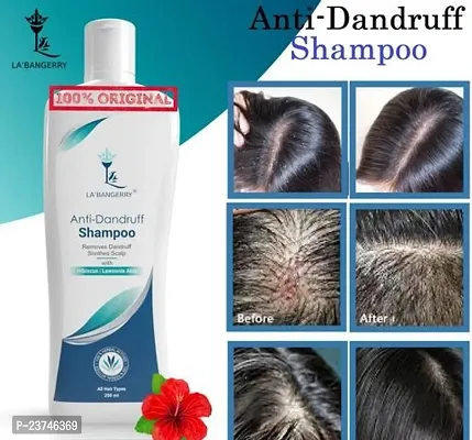 Original Anti Dandruff Shampoo For Dandruff Control 250Ml Pack Of 1-thumb0