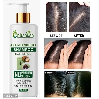 Anti-Dandruff Shampoo 200ml-thumb0