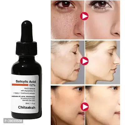 2% Salicylic Acid Serum for Acne - 30ml