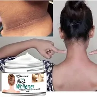 Neck Cream for Acanthosis Nigricans | For Dark Body Parts Like Neck, Ankles, Knuckles, Armpits, Thighs, Elbows| Exfoliant-thumb2