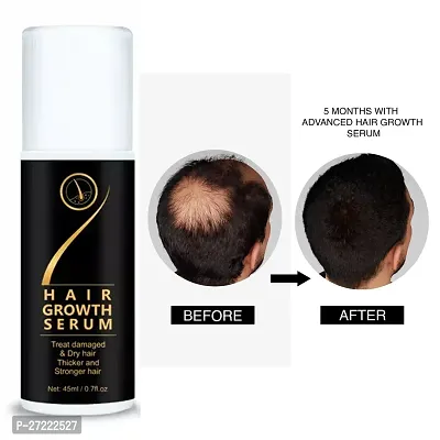 Hair Growth Serum 45ml-thumb3