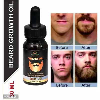 FAIR INDIANS BEARD GROWTH OIL Advanced natural Beard GROWHT Booster oil 30 mil Hair Oil  (30 ml)-thumb0