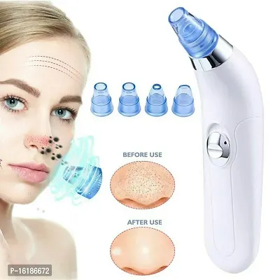 4 in 1 Multi-function Blackhead Remover Tool | Electric Derma suction Machine for Whitehead | Acne Pimple Pore Cleaner Vacuum tools | Facial Cleanser Device for Face, Nose and Skin Care ,DERMA SUCTION