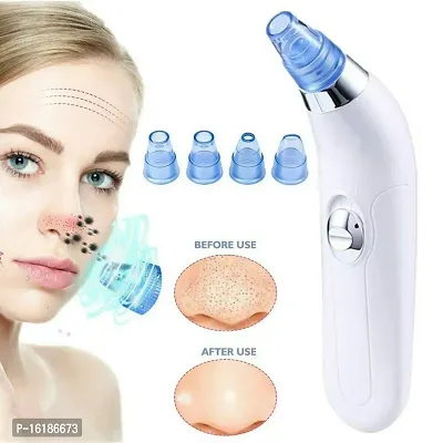 4 in 1 Multi-function Blackhead Remover Tool | Electric Derma suction Machine for Whitehead | Acne Pimple Pore Cleaner Vacuum tools | Facial Cleanser Device for Face, Nose and Skin Care ,DERMA SUCTION-thumb0