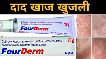 Four Derm  Anti fungal Cream  - for Ringworm, itching, Eczema  Fungal Infection 20 Gm ( PACK OF 2)-thumb4