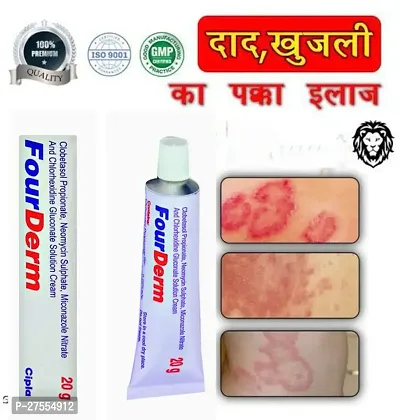 Four Derm  Anti fungal Cream  - for Ringworm, itching, Eczema  Fungal Infection 20 Gm ( PACK OF 2)-thumb2