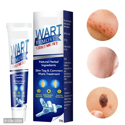 Wart Remover Cream Extract Skin Face Tag Extract Corn Treatment Ointment Painless For Men  Women Childrens