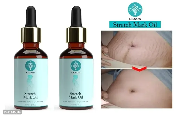 Premium Stretch Mark Remover Oil 30 ML Pack of 2-thumb0