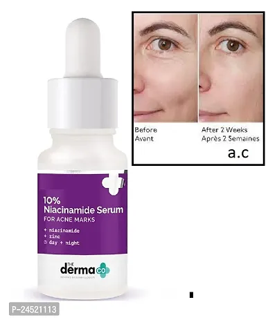 10 % NIACINAMIDE FACE SERUM PACK OF 1-thumb0