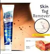 Wart Remover Gel, Wart Remover Ointment Treatment Cream Skin Tag Removal Herbal, Massa Cream-thumb2