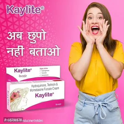 Kaylite Skin Whitening Face Cream 15 gm Look as young - Acne Care Face Cream, Face Cream For Oily Skin, Anti Pimple Cream, Face Cream For Women, Face Cream For Men and women 15gm (Pack of 2)