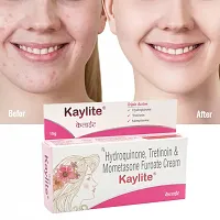 Kaylite Skin Whitening Night Face Cream - Acne Care Face Cream, Face Cream For Oily Skin, Anti Pimple Cream, Face Cream For Women, Face Cream For Men and women 15 gm-thumb3