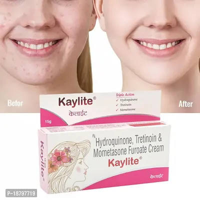 Kaylite Skin Whitening Night Face Cream - Acne Care Face Cream, Face Cream For Oily Skin, Anti Pimple Cream, Face Cream For Women, Face Cream For Men and women 15 gm-thumb4