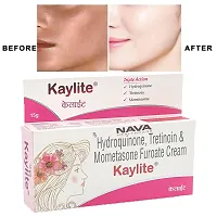 Kaylite Face Cream Night Cream (Pack of 4) 60 gm-thumb2
