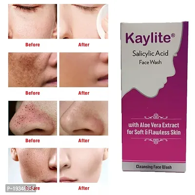Kaylite Salicylic Acid Face Wash for All Skin Types 60 ml Face Wash  (60 ml)-thumb5