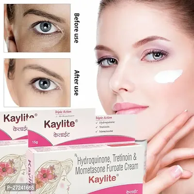 Kaylite Face Cream for Melasma, Dark spots, Pigmentation (Pack of 2) 30 GM Face Cream.-thumb0