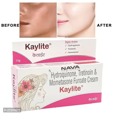 Kaylite Face Cream for Melasma, Dark spots, Pigmentation (Pack of 1) 15 GM Face Cream