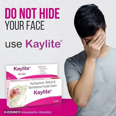 Kaylite Face Cream for Melasma, Dark spots, Pigmentation (Pack of 3) 45 GM Face Cream.-thumb5
