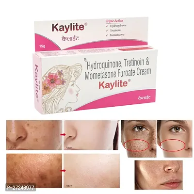 Kaylite Face Cream 30gm(Pack of 2) for Anti Ageing, Dark Spot Removal, Skin Whitening  Brightening, Acne  Scars Removal, Deep Hydration of Skin