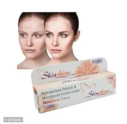 SkinShine Cadila Cream 15 Gm (Pack Of-1)-thumb0