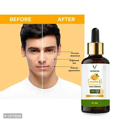 Skin Correct Face Serum For Healthy Skin-thumb0