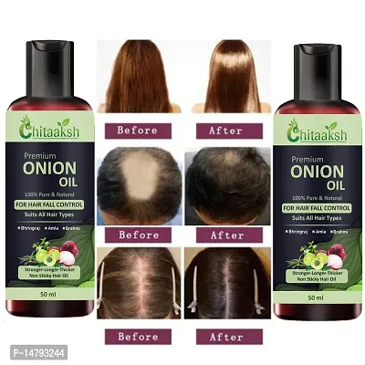 Onion Oil for Hair Regrowth  Hair Fall Control Hair Oil (pack of  PACK OF 2-thumb0