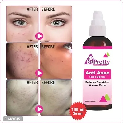 Bepretty Professionals Anti Acne Face Serum Black Spot Remover,Control Blemishes and pigmentation 100 ml