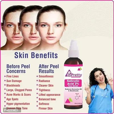 BePretty Professional 2% Salicylic Acid Serum for Blackheads, Acne and Open Pores | Reduces Excess Oil and Bumpy Texture -100% Visible results 100 ML
