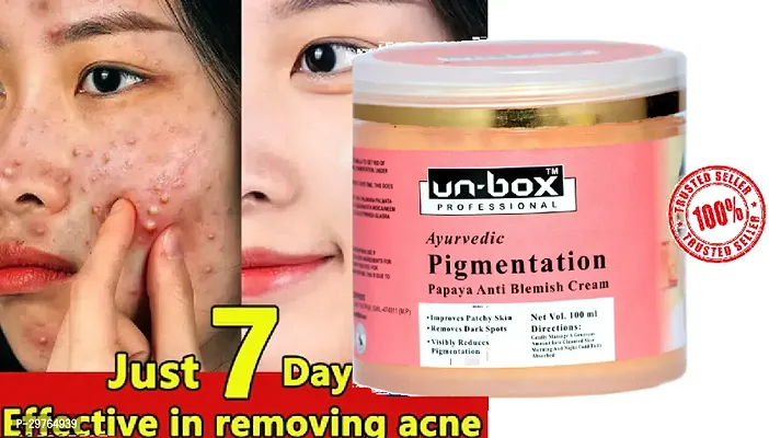 Unbox Nuskhe Papaya Pigmentation , Skin Whitening Cream ,Best Pigmentation Cream  100 Gm