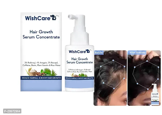 Wish-Care Hair Growth Serum Concentrate-thumb0