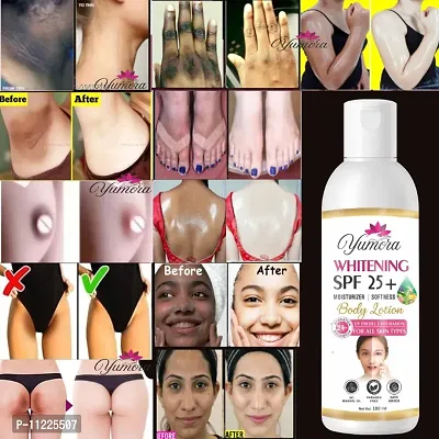Yumora Intense Moisture Skin Whitening Body Lotion With SPF 25+ 100ml For Men And Women-thumb0