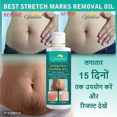 Yumora Safe Organic Stretch Mark Oil Mark Removal - Natural Heal Pregnancy Breast, Hip, Legs, Made with Organic Ingredients -50 ml (Pack Of 1)-thumb0