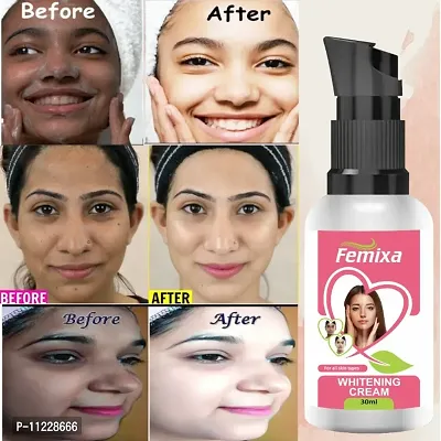 FEMIXA  Pure Skin Whitening Cream Look as young as U feel , NOW YOUR SKIN DARKNESS PROBLEMS WAITING TIME IS OVER, WE ARE SERVE YOU BEST BRANDED RESULT BASE PRODUCT.(30 g, PACK OF 1)-thumb0