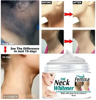 FEMIXA Neck Back Whitening Cream For Remove Dark Underarm Black Spots  Warts For Men  Women-50gm-thumb0