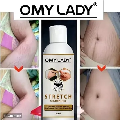 OMY LADY  Stretch Marks Removal Oil (50ml)-thumb4