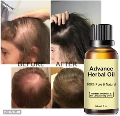 Advance Herbal Oil 30 Ml Natural Ingredients With Sesame Oil, Coconut Oil Hair Oil (30 Ml)-thumb0