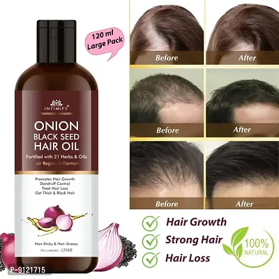 Intimify Onion Oil For Hair Growth, Anti Dandruff Oil, Herbal Oil, Hair Fall Oil, Red Onion Oil, Ayurvedic Oil-thumb0