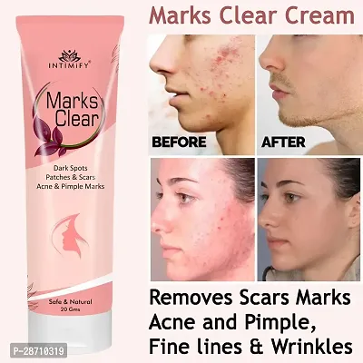 Intimify Marks Clear  Anti-Acne Cream For Face-thumb0