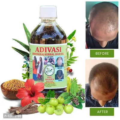 Adivasi Bhringraj Herbal Hair Oil 200ml (100% NATURAL .Basically Made By Pure Adivasi Ayurvedic Herbs)-thumb0