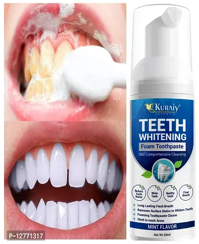 KURAIY Safe Hygiene Oral Hygiene Teeth Cleaning Mint Teeth Whitening Mousse Teeth Cleaning Tools Removes Stains Teeth Cleaning Breath Fresh-thumb0