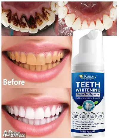 KURAIY 100%Teeth Whitening Mousse V34 Colour Corrector Teeth Effectively Remove Yellow Plaque Smoke Stain Dental Cleaning Fresh Breath-thumb0