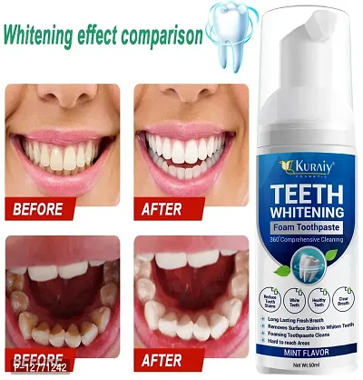 KURAIY - Teeth Whitening, Plaque Remover, Toothpaste, Pearl Powder, Cleaning, Oral Hygiene, Toothbrush, Dental Tools-thumb0