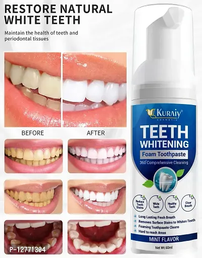 KURAIY Safe Teeth Whitening Mousse V34 Colour Corrector Teeth Effectively Remove Yellow Plaque Smoke Stain Dental Cleaning Fresh Breath-thumb0