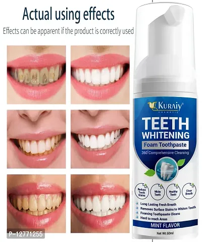 KURAIY Teeth Whitening Mousse Removes Smoke Tea Coffee Stains Toothpaste Dental Bleaching Deep Cleaning Fresh Breath Oral Hygiene-thumb0
